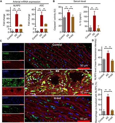 Anti-malarial artesunate ameliorates atherosclerosis by modulating arterial inflammatory responses via inhibiting the NF-κB–NLRP3 inflammasome pathway